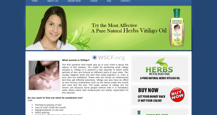 Herbsvitiligooil.com Drugs Online