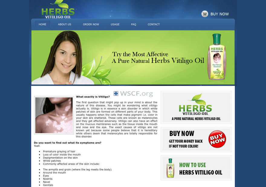 Herbsvitiligooil.com Drugs Online
