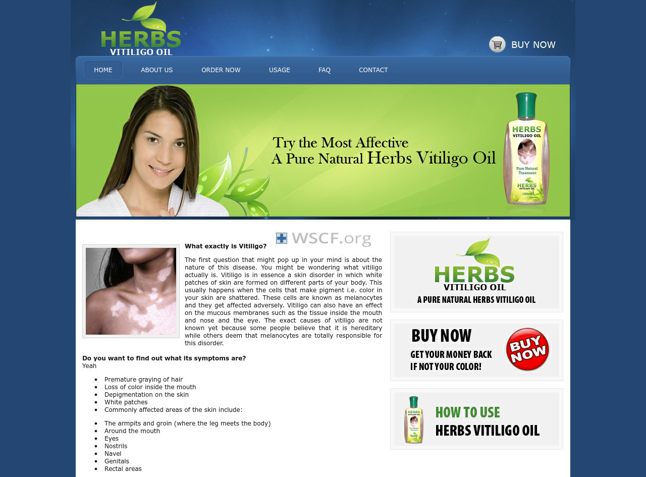 Herbsvitiligooil.com Drug Store Online