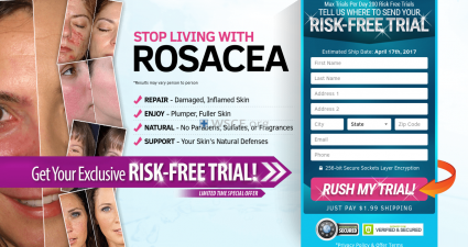 Rosaceaoptions.com Fast Worldwide Delivery